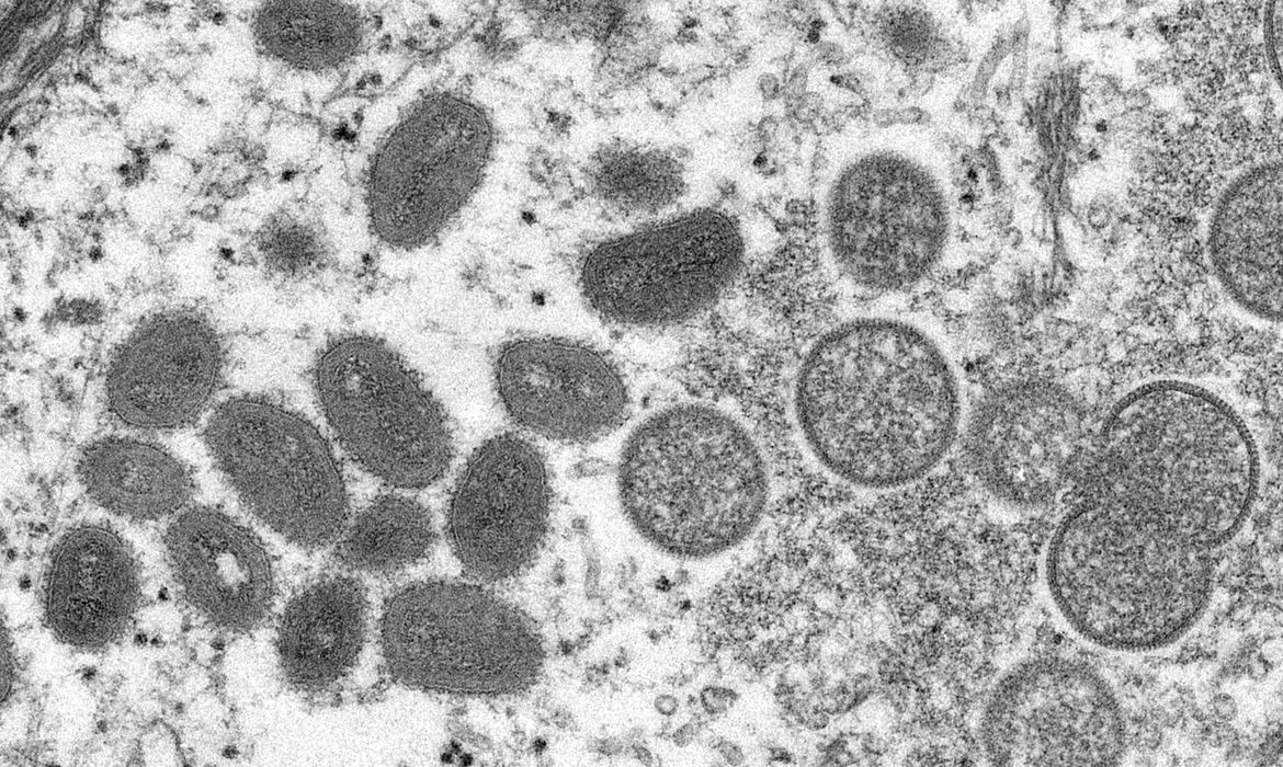 Doença conhecida como varíola dos macacos teve ocorrência registrada na Europa em maio deste ano e chegou ao Brasil em junho. Goiás tem seis casos suspeitos em investigação